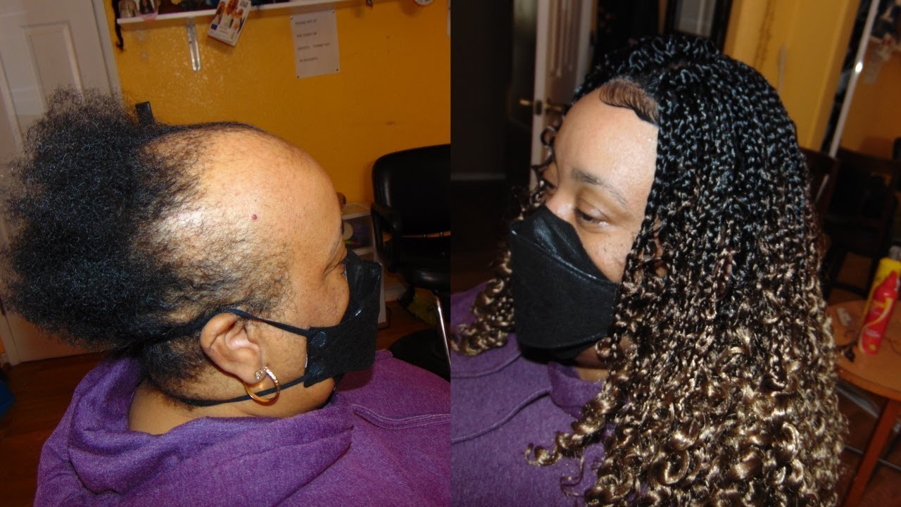 BEST HOW TO CROCHET BRAID METHOD FOR ALOPECIA, & HAIR LOSS