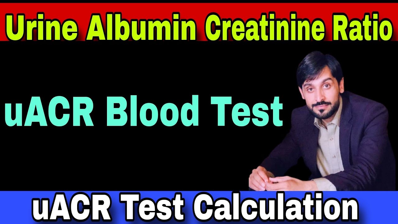 Urine Albumin Creatinine Ratio Test | uACR Test | uACR Test Procedure | uACR Test Calculation