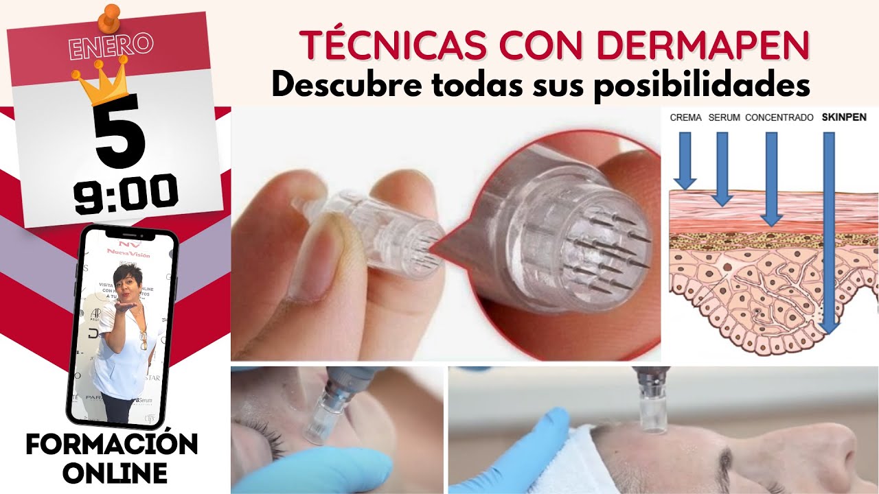 Técnicas con Dermapen. ¿Cuándo utilizo el dermapen?