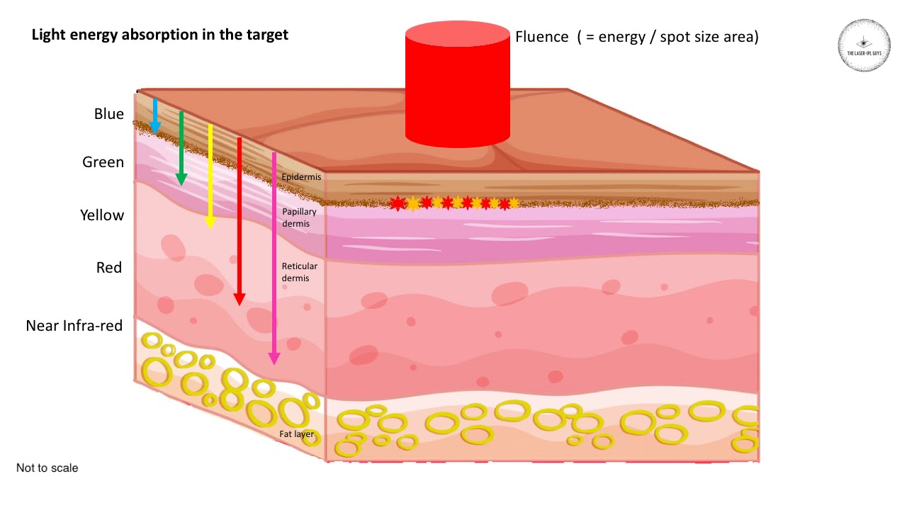 Light absorption in skin - where does it go?