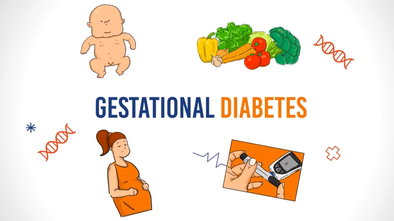 Gestational Diabetes