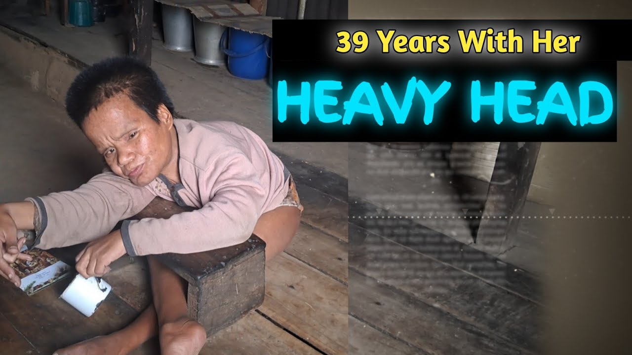 39 Years Surviving With Heavy Head TINY Body.