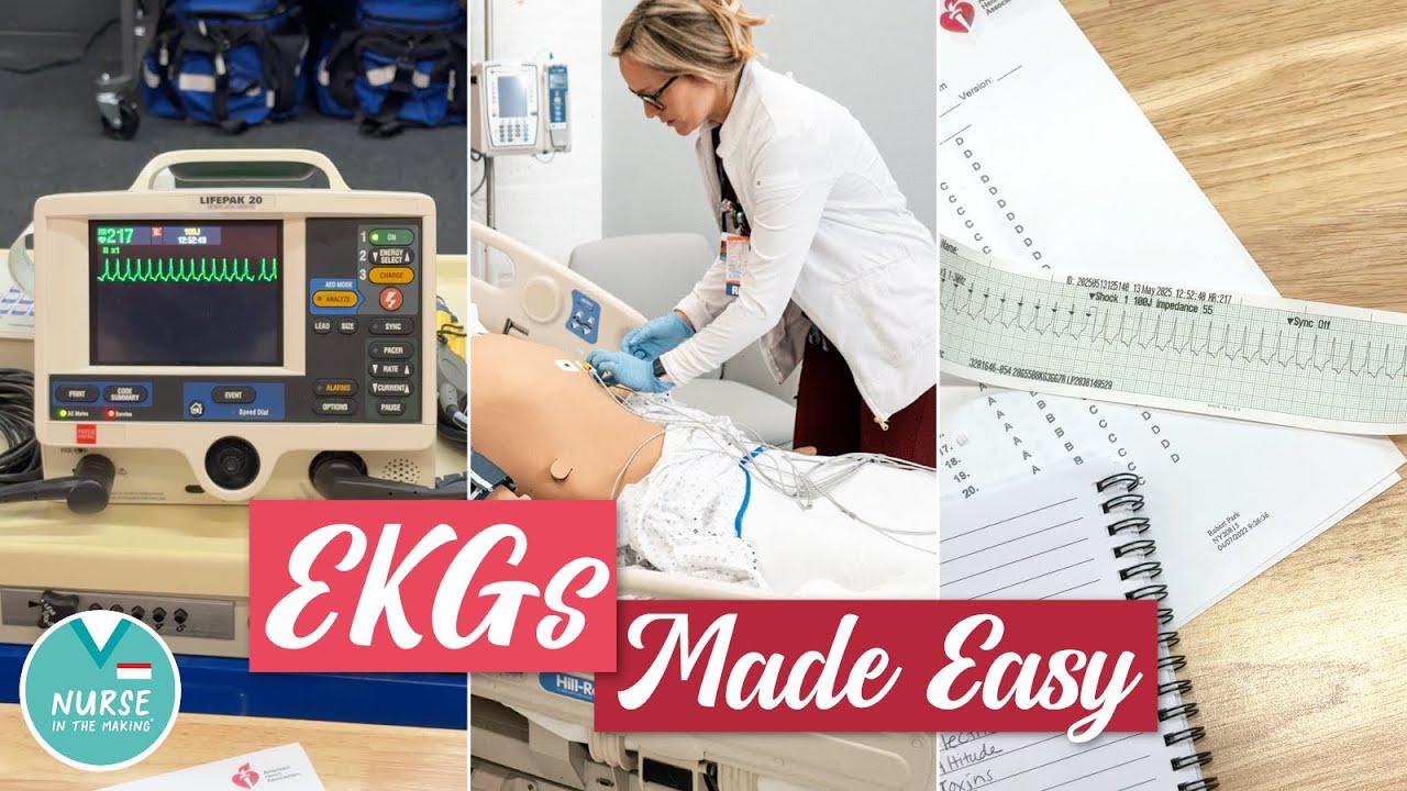 EKGs Made Easy » Practice EKG Rhythms