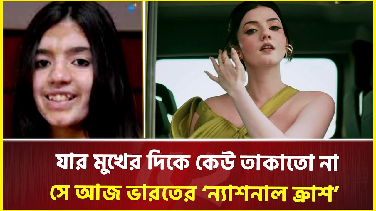 দুরারোগ্য ত্বকের সমস্যা মোকাবিলা করা মেয়েটি আজ ‘ভারতীয় বার্বি’ | Aastha Shah | Instagram