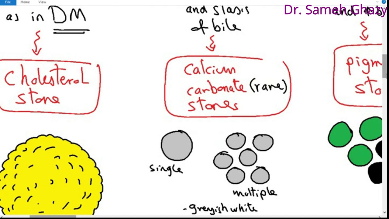 systemic pathology 74 : hepatobiliary and pancreas 4 (diseases of gall bladder )
