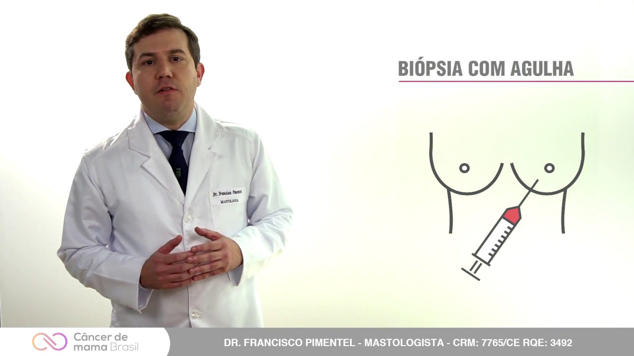 BIÓPSIA MAMÁRIA ASSISTIDA À VÁCUO OU MAMOTOMIA