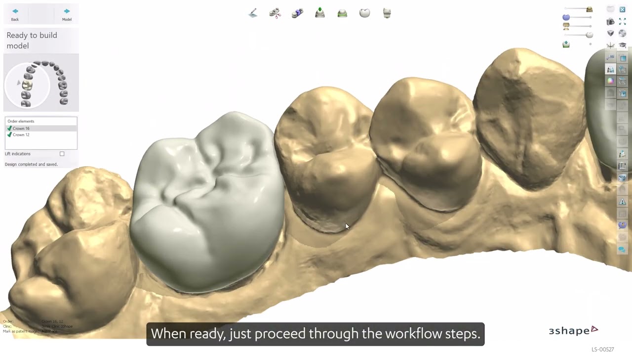 How to use Automate AI-design in 3Shape Dental System