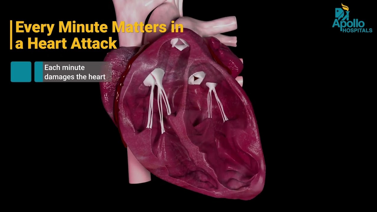 Angioplasty Explained | Symptoms, Procedure & Benefits