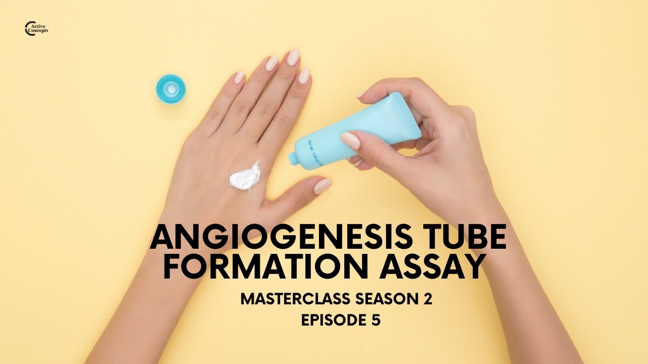 S2, Episode 5: Angiogenesis Tube Formation Assay