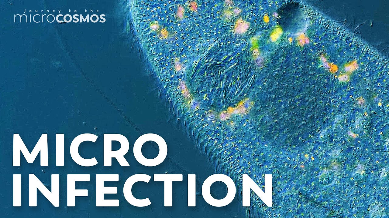 Our Paramecia Are Infected