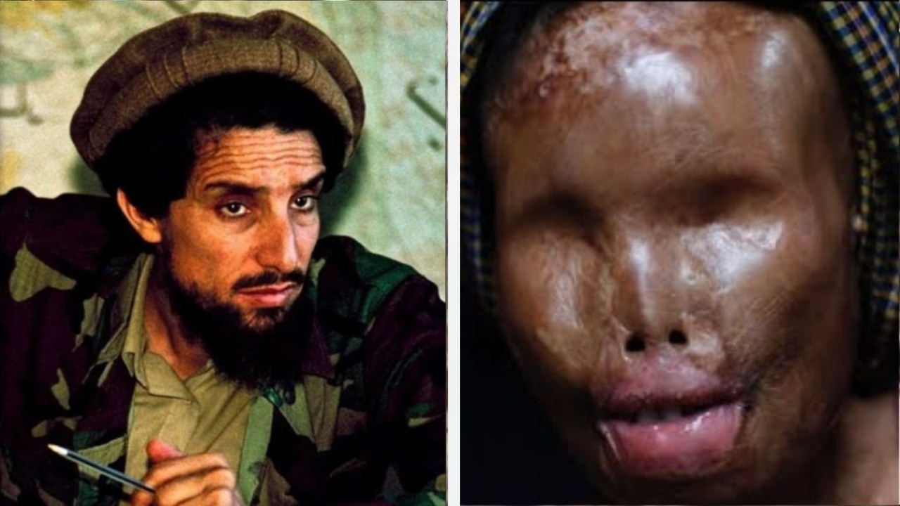 The SCARIEST Side Of Taliban *Warning HARD TO STOMACH