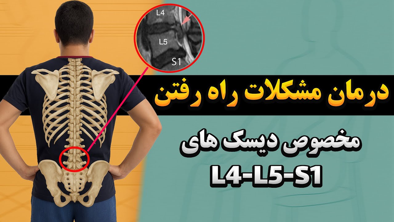 درمان تضمینی مشکلات راه رفتن در دیسک های L4-L5-S1 با 3 حرکت تخصصی