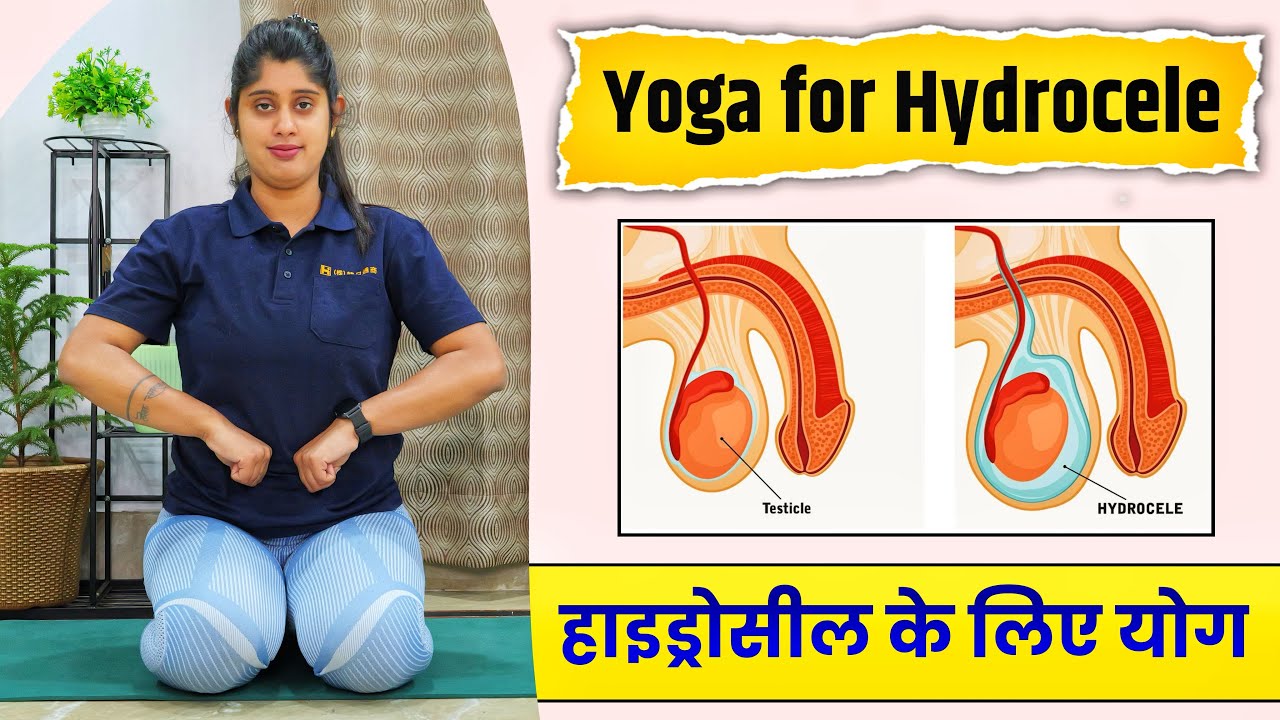 पुरुषों में हाइड्रोसील को ठीक करने के लिए योगासन | Yoga for Hydrocele Problem | @Yogawale