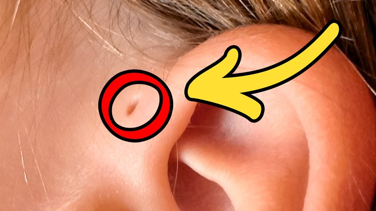 10 Body Features Not Everyone Has