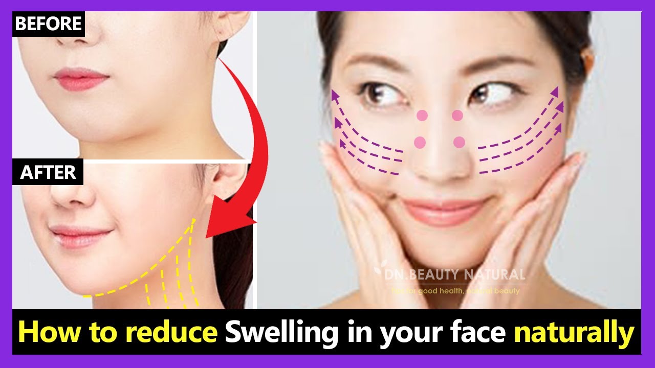 How to reduce swelling face, face bloating quickly & slim down Puffy face naturally | Facial massage
