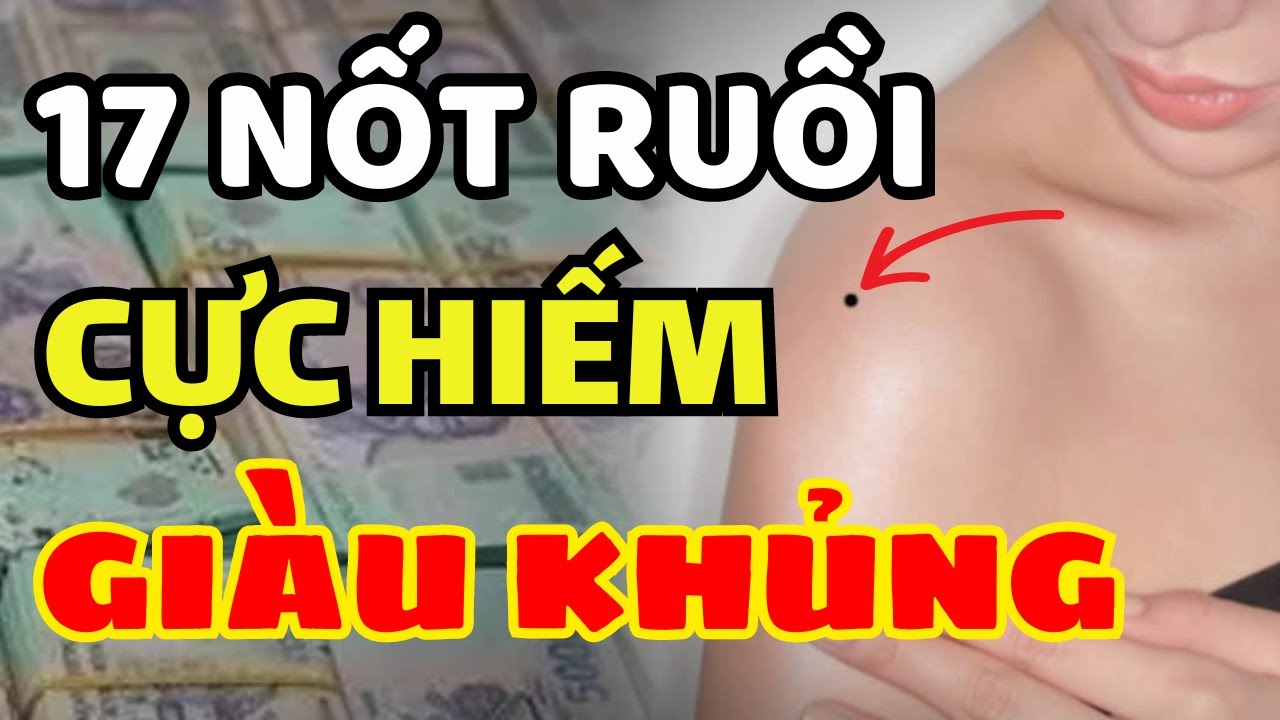 17 Nốt Ruồi Đại Phú Quý Trên Cơ Thể Số Mệnh Trời Ban Giàu Có, Cả Đời Hưởng Lộc