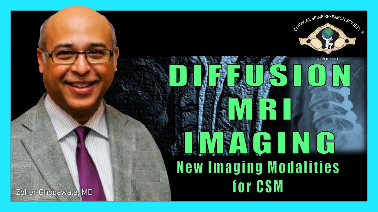 Cervical Myelopathy: Diffusion MRI Imaging - Dr. Zoher Ghogawala