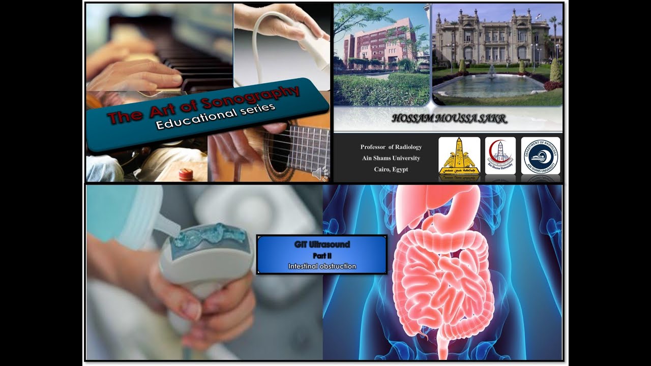 GIT US PART II INTESTINAL OBSTRUCTION