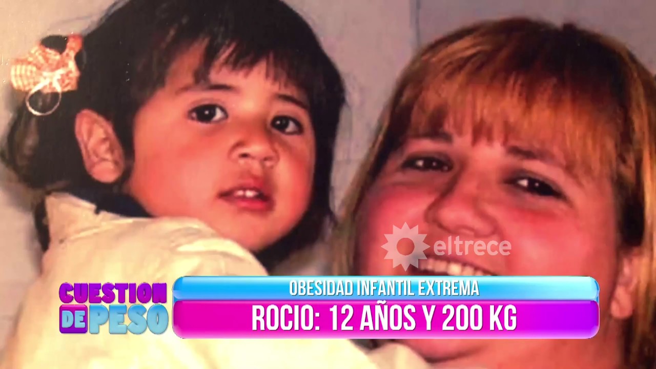 Obesidad infantil extrema: Rocío tiene 12 años y pesa 200 kilos