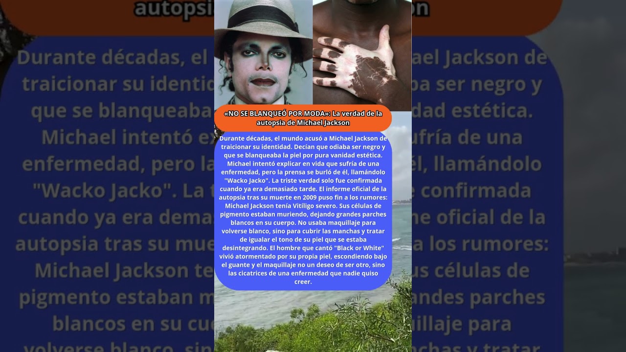 «NO SE BLANQUEÓ POR MODA»: La verdad de la autopsia de Michael Jackson