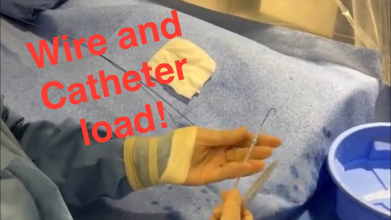 Loading Catheters and Wire removal