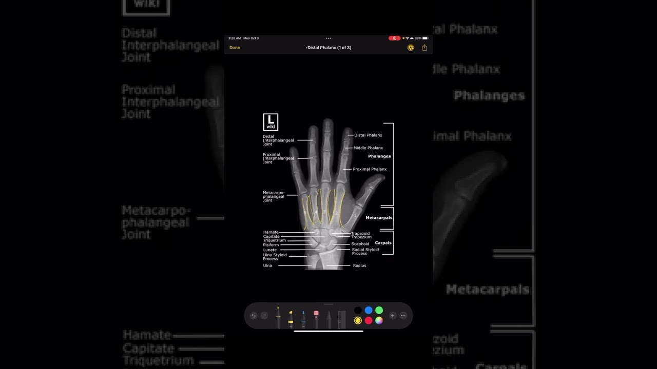 Image Evaluation of a Hand X-Ray