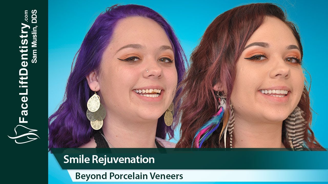 Bad Teeth, Small Chin, Jaw Pressure Fixed, One Treatment