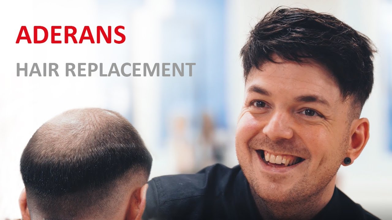 Aderans Hair Replacement, oplossingen voor mannelijke kaalheid