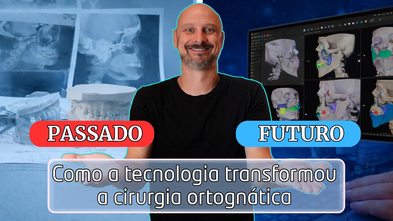 Cirurgia Ortognática Digital: A Evolução do Planejamento do Analógico ao 3D