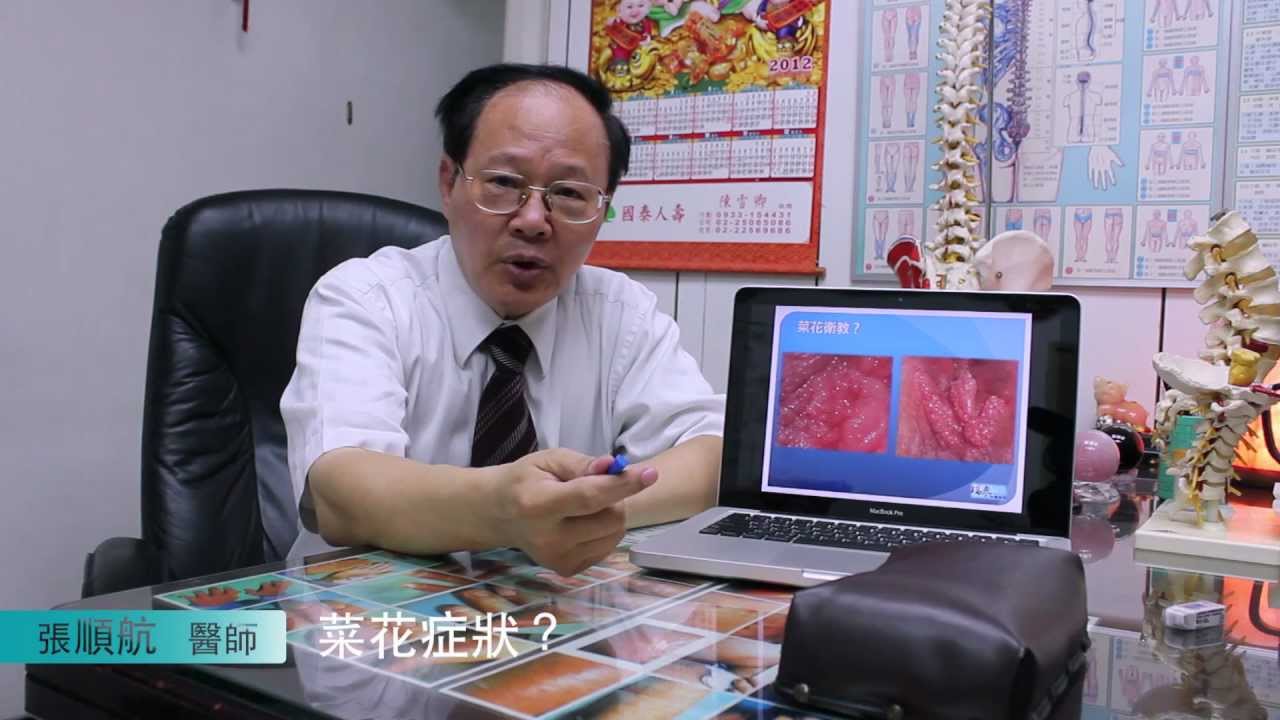 菜花 、菜花治療-瑞泰中醫 菜花病毒、口腔菜花、肛門菜花