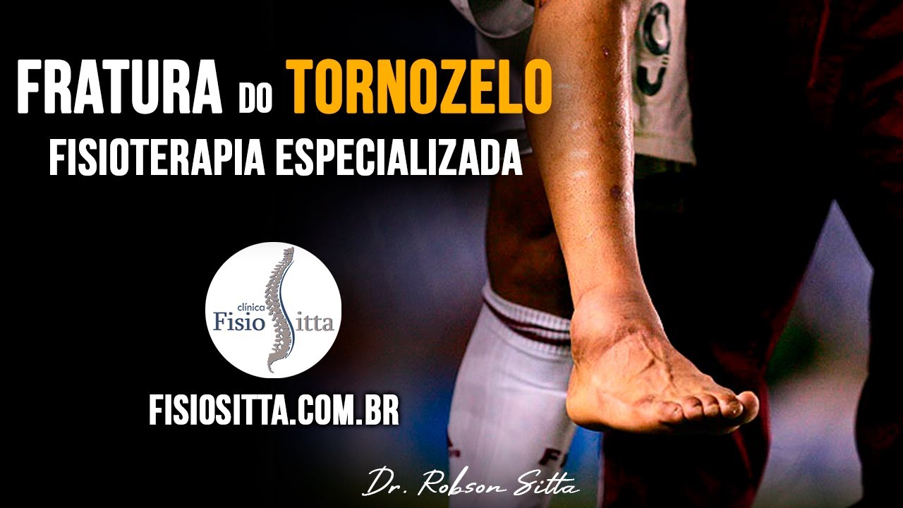 TORNOZELO ENTORSE LUXAÇÃO FRATURA BIMALEOLAR TRATAMENTO de FISIOTERAPIA Clínica Dr. Robson Sitta
