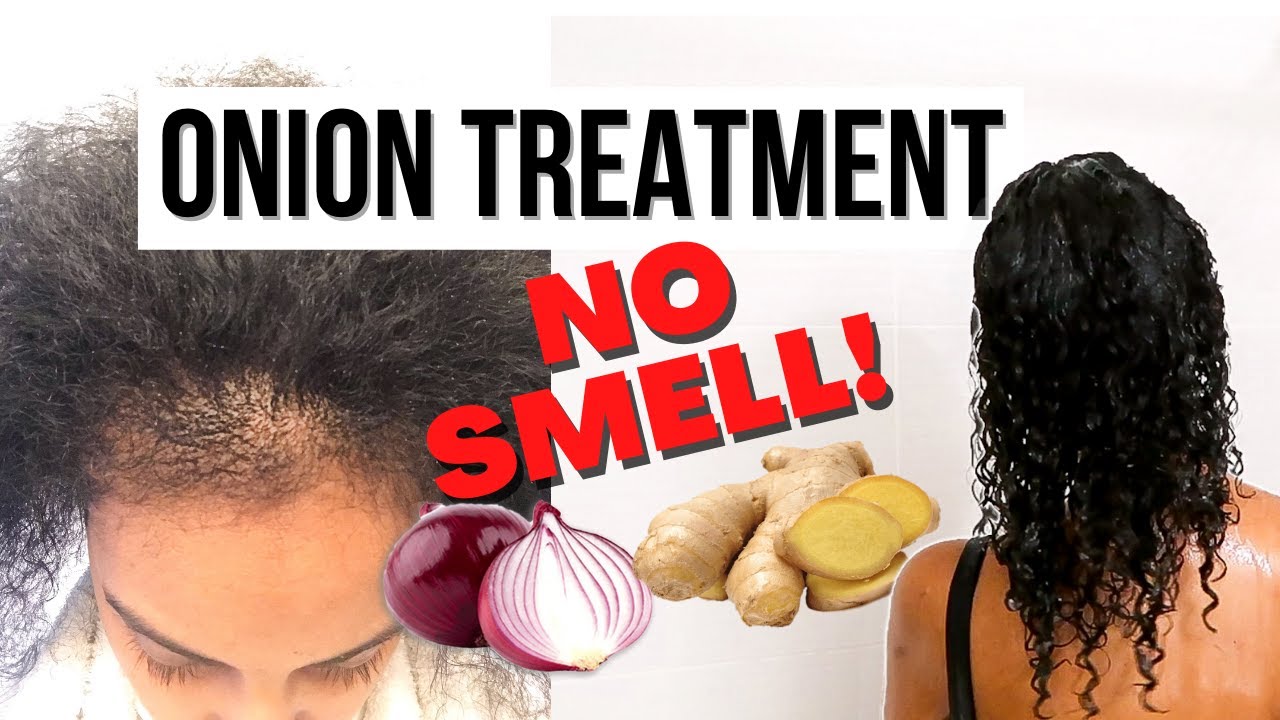 ONION TREATMENT WITHOUT THE SMELL *Weekly Onion Hair Growth Treatment* NO SMELL