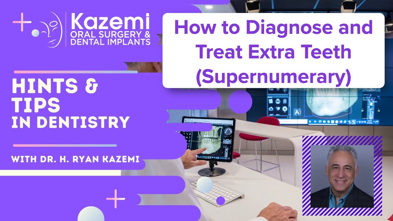 Как диагностировать и лечить дополнительные зубы (сверхкомплектные зубы)