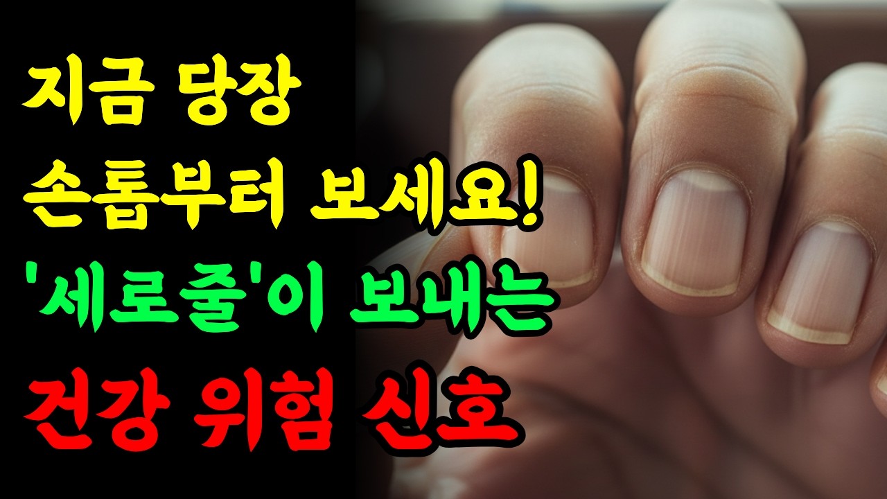 지금 당장 손톱부터 보세요! '세로줄'이 보내는 건강 위험 신호
