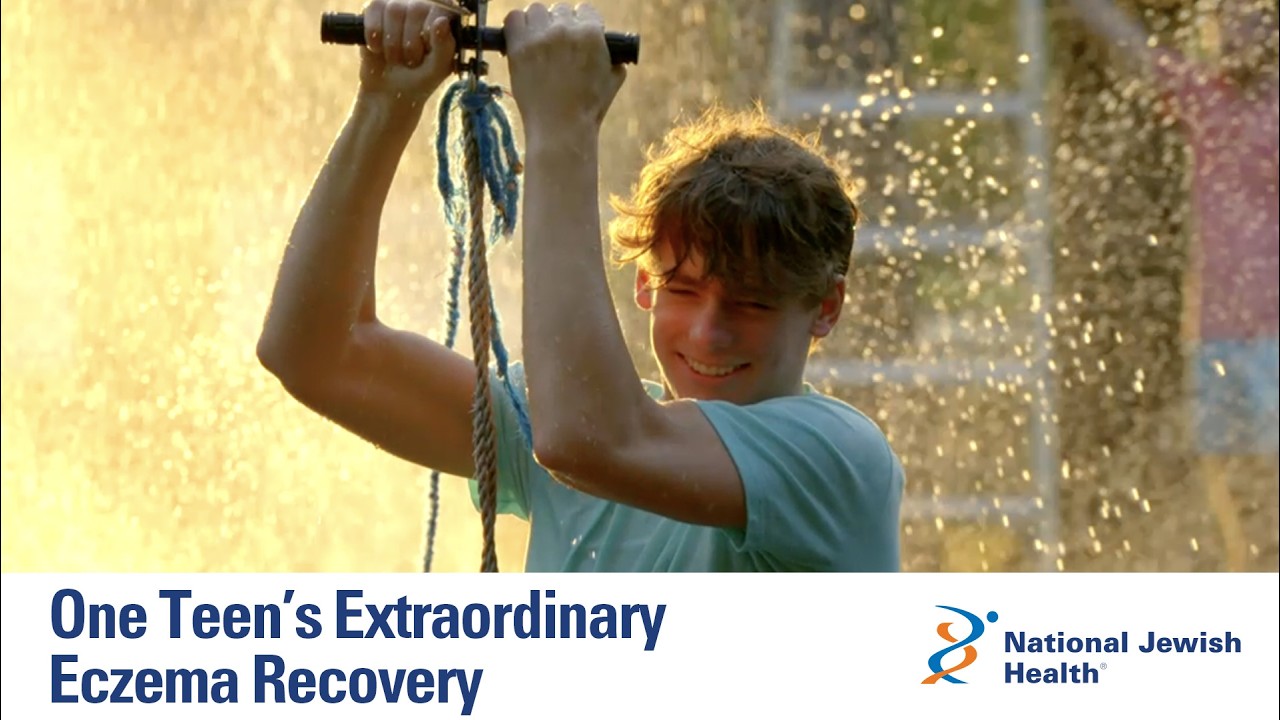 From Severe Eczema and Food Allergies to a Normal Life | Kade’s Story at National Jewish Health