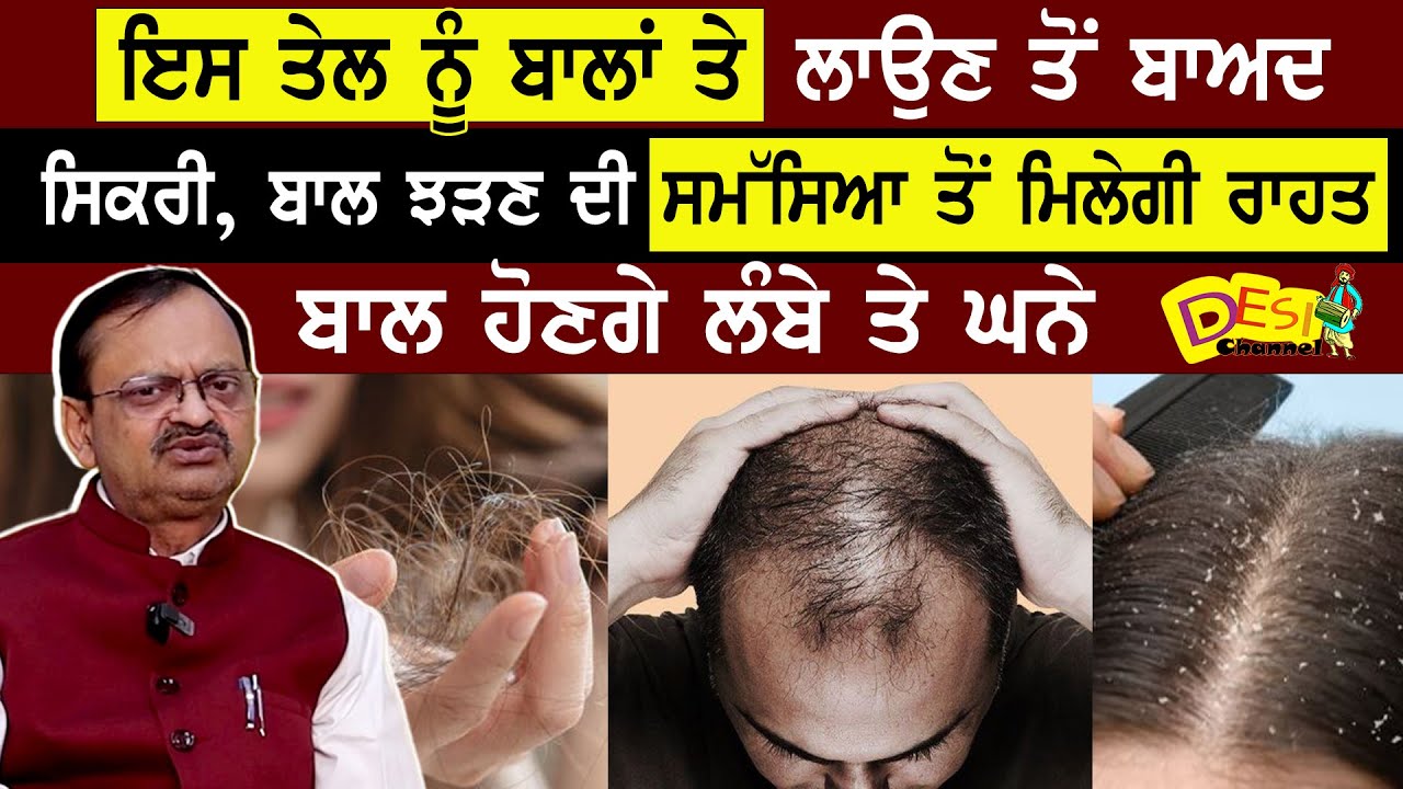 Hair Loss , Dandruff & Hair fall Problem Treatment Subhash Goyal Health Show | Ayurvedic Remedies