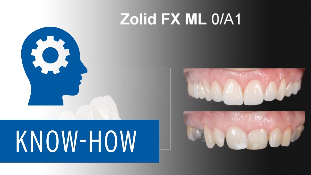 Next Level Zirconia – Highly translucent & esthetic