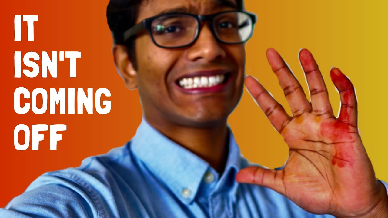 Traumatic Day in the life of a Cambridge University Medical Student: 5 Lessons I Learnt