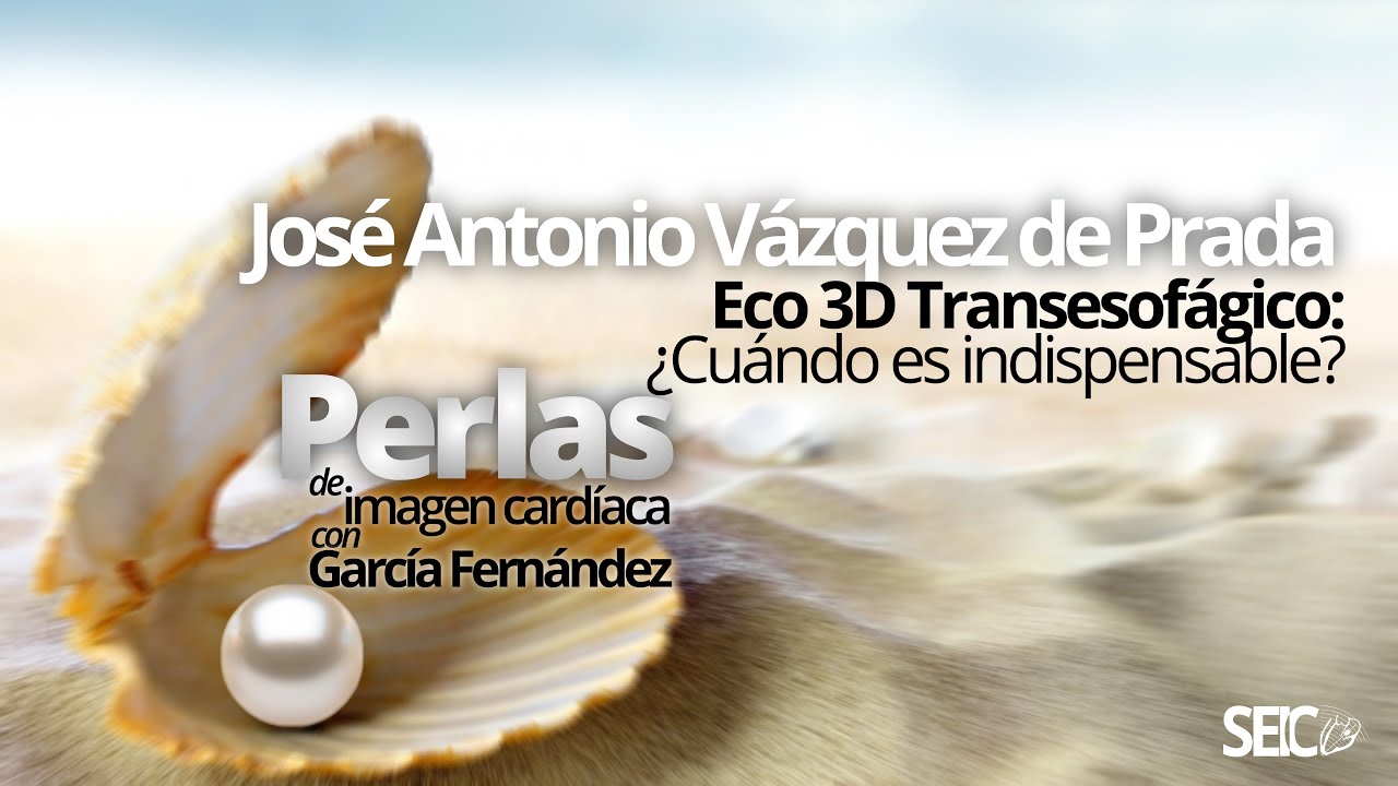 Eco 3D Transesofágico: ¿Cuándo es indispensable?