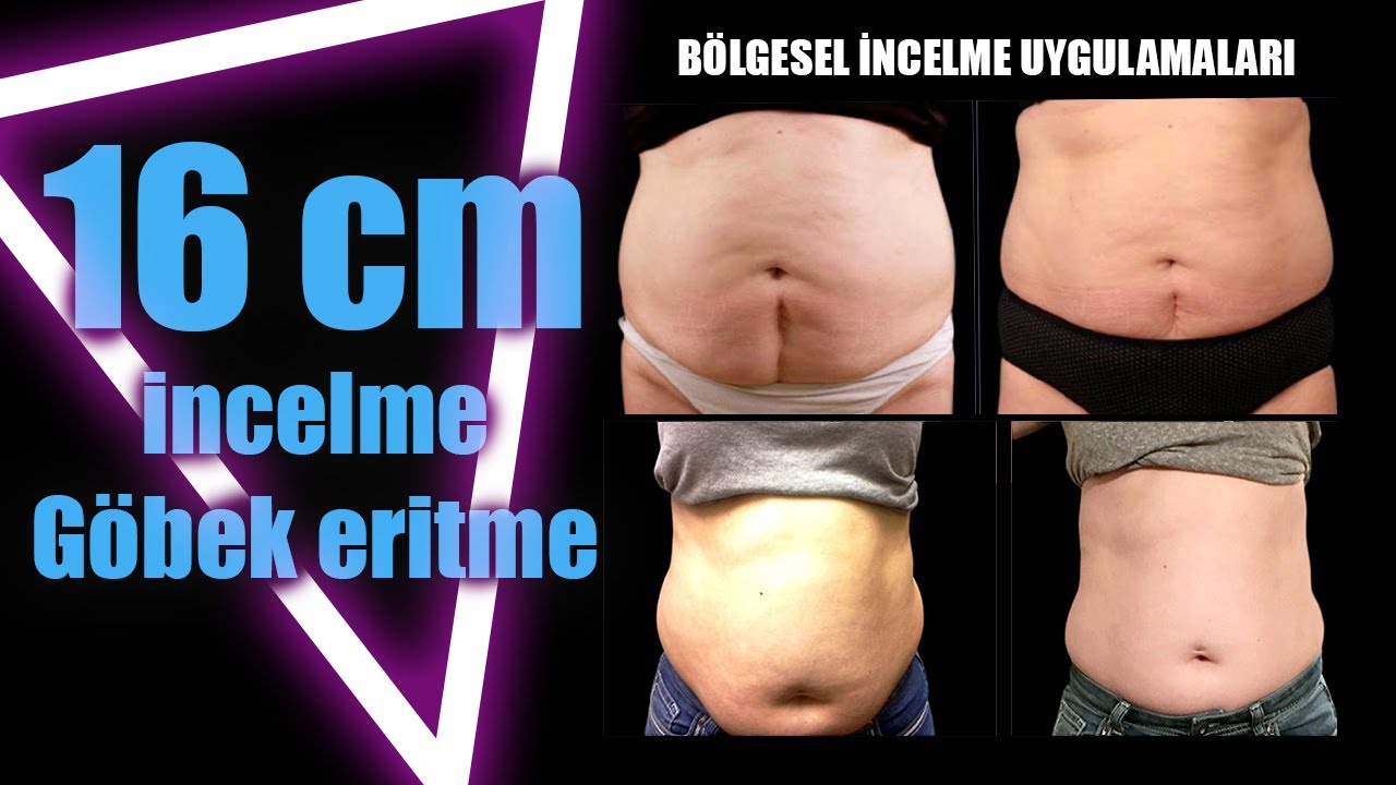 HIZLI GÖBEK ERİTME | Basen Küçültme | Bölgesel İncelme Uygulamaları