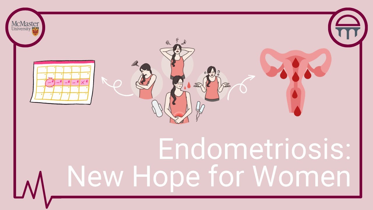Endometriosis New Hope for Women Video