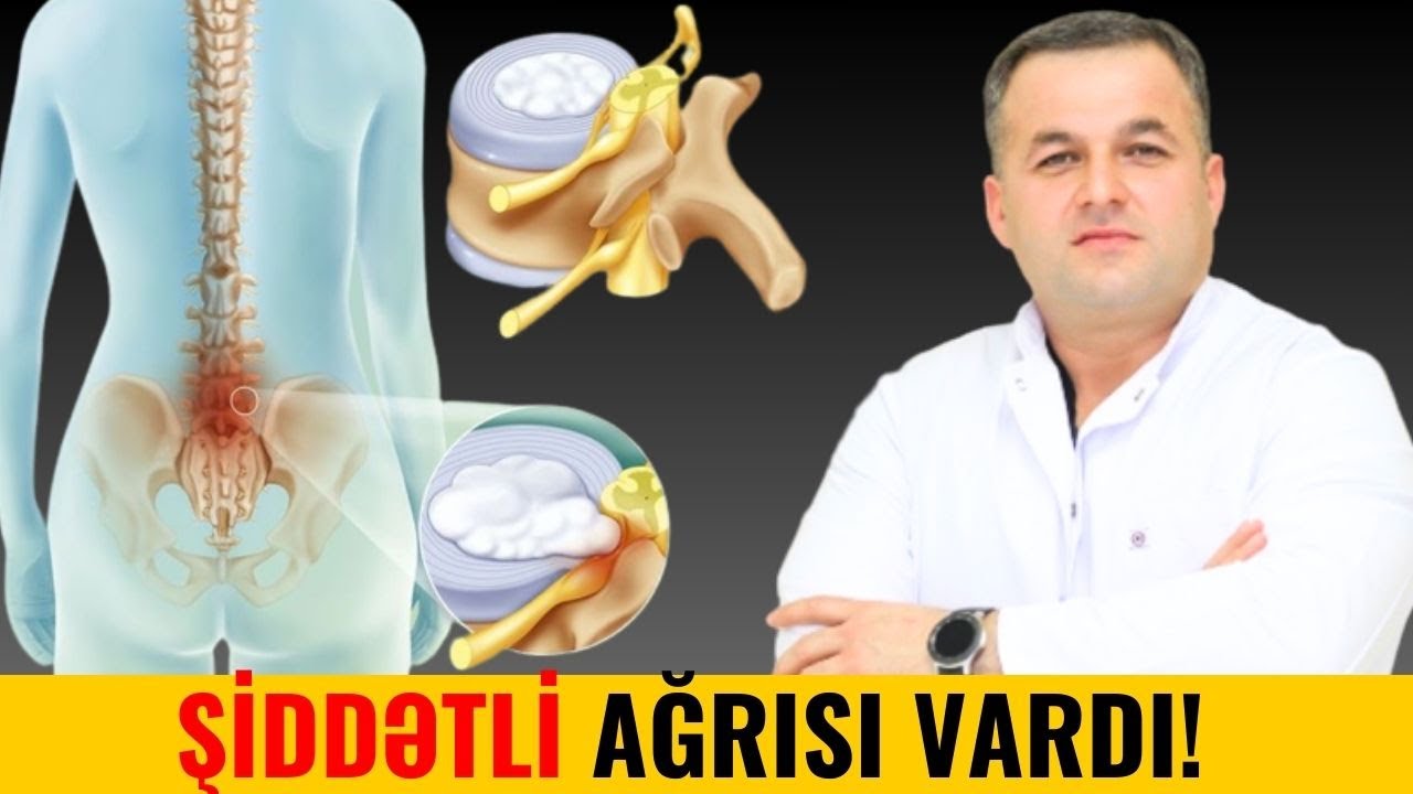 İflic Dərəcəsinə gətirən Bel Yırtığını həkim belə Müalicə etdi!