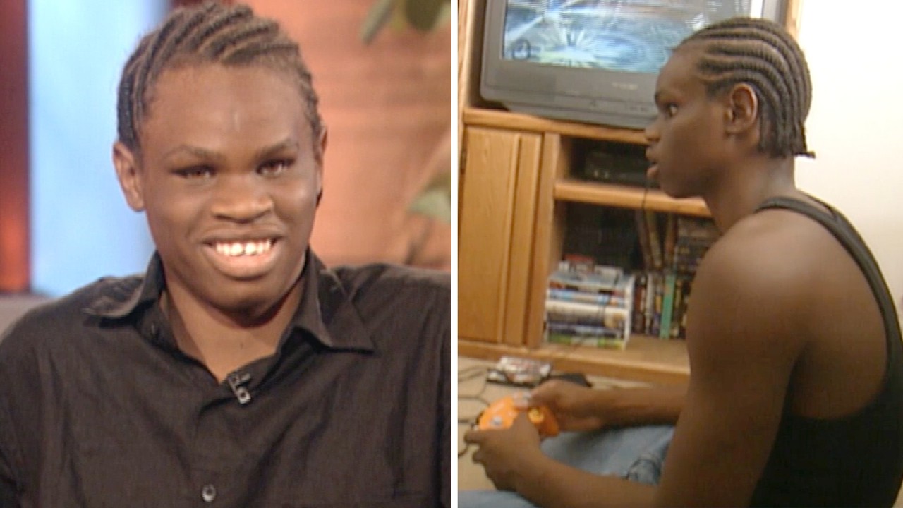 Blind Teen Shocked Everyone With His Way of Seeing
