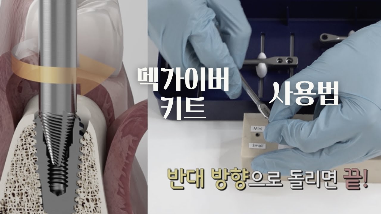 [2023 신제품] MegGyver Kit Manual