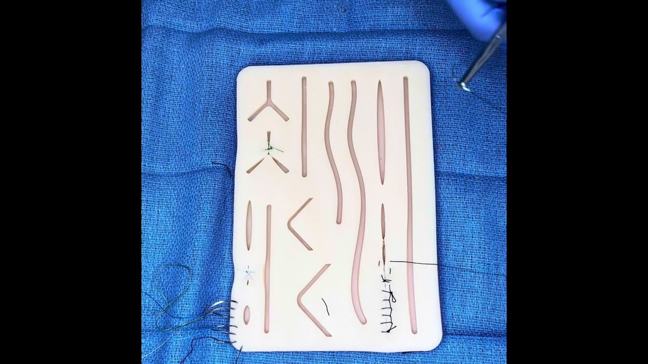 A running horizontal mattress suture