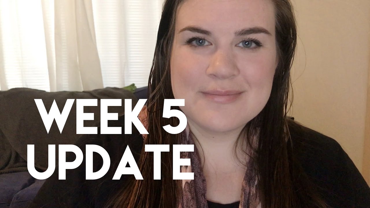 5 Weeks Post Op *RNY gastric bypass* All smiles!
