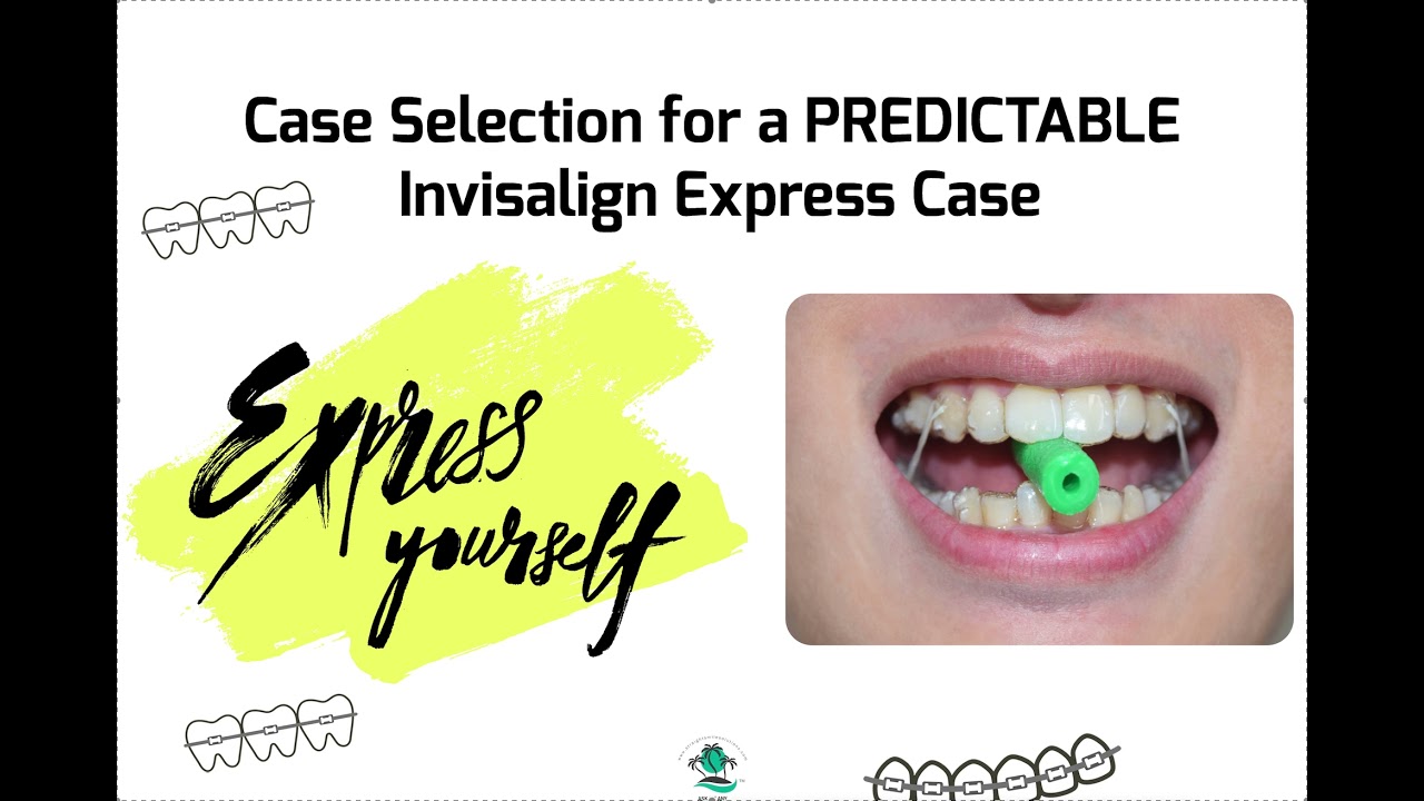 Case Selection for  Predictable Invisalign Express