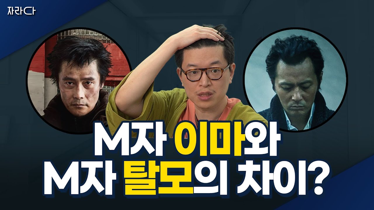 M자이마 M자탈모 차이점 알려드릴게요