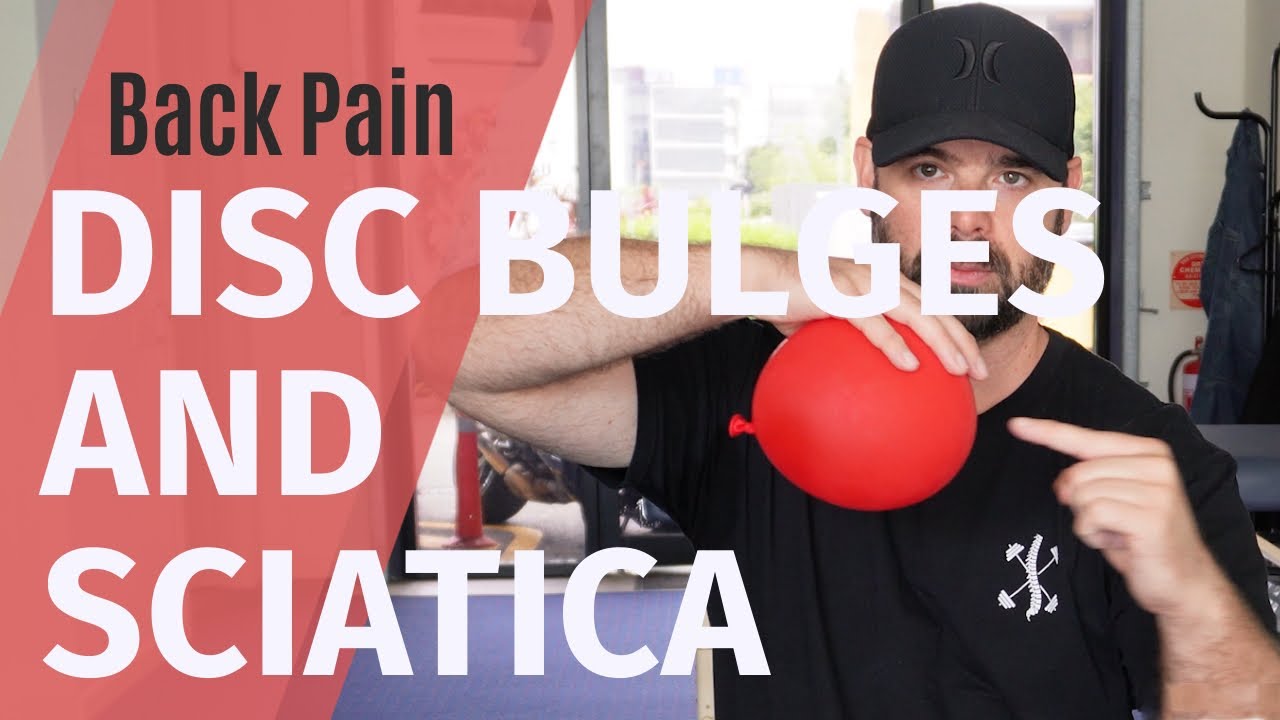 Healing Disc Bulges and Sciatica - Part 1