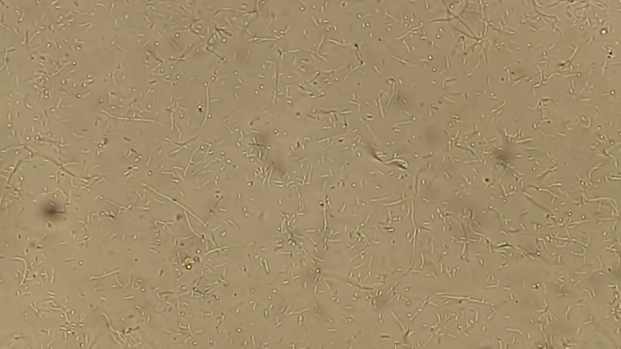 Bacterial Motility |Aeromonas hydrophila |Mag.1600X